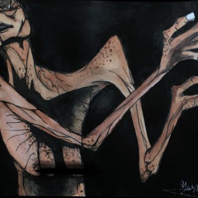 Blessed with a disease